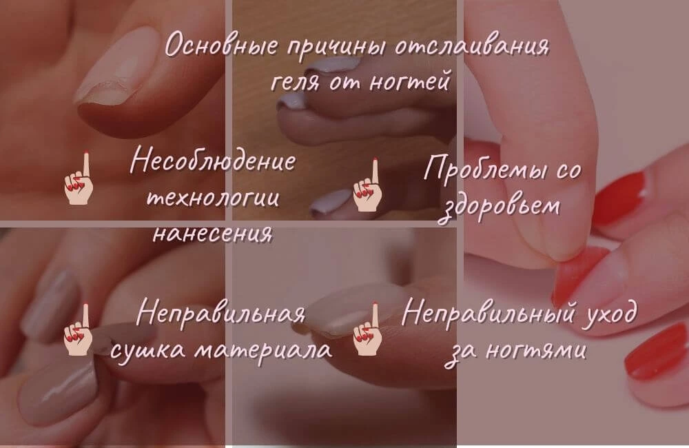 Причины отслаивания геля от ногтей